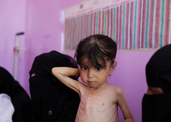 Malnutrition worsening in Yemen’s government-controlled areas, UN says