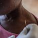 Poor sanitation and supply shortages fuel child mpox deaths in DRC