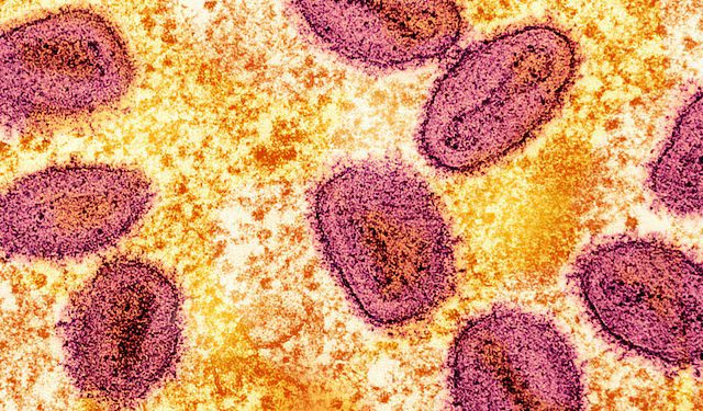 Philippines detects first mpox case this year, yet to determine strain