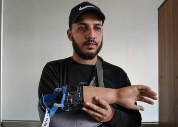 Bangladeshi students who lost their hands during protests to overthrow the government in August have been fitted with robotic replacements (Abdul Goni) (Abdul Goni/AFP/AFP)