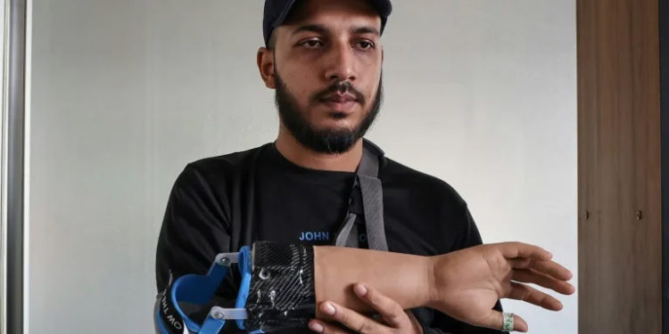 Bangladeshi students who lost their hands during protests to overthrow the government in August have been fitted with robotic replacements (Abdul Goni) (Abdul Goni/AFP/AFP)