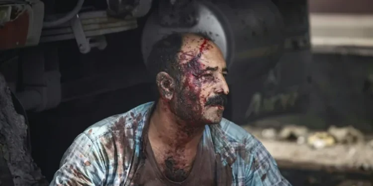 25 killed, 1,000 injured in huge Iran port blast